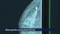 8. epizóda | 22. 9. 2026 | Miroslav Tomáš
